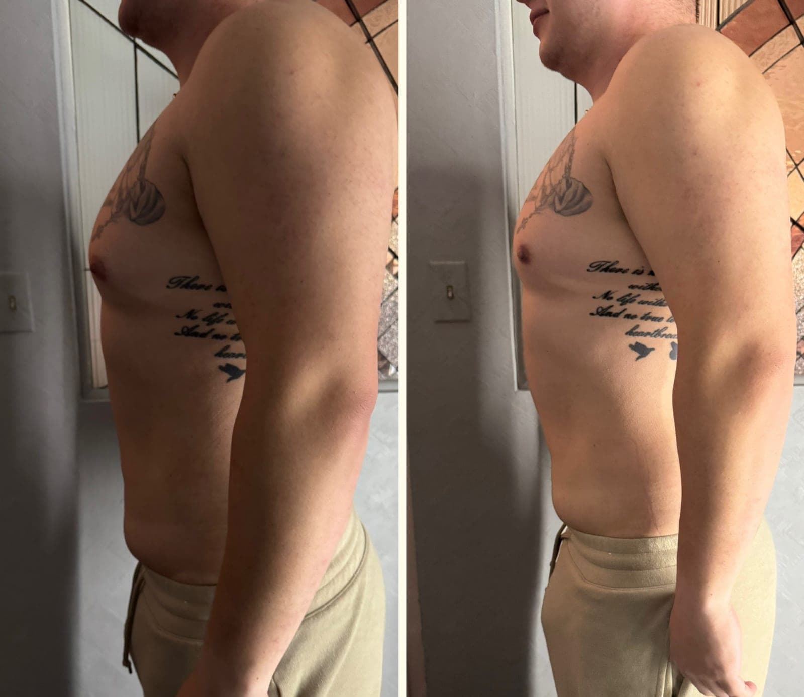 Real before and after result from a Bossa body sculpting treatment series.